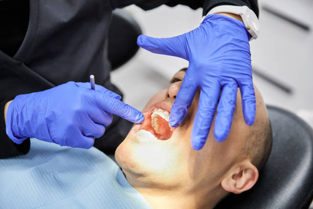 Best Emergency Dental Care for Sports Injuries in Central City, IL
